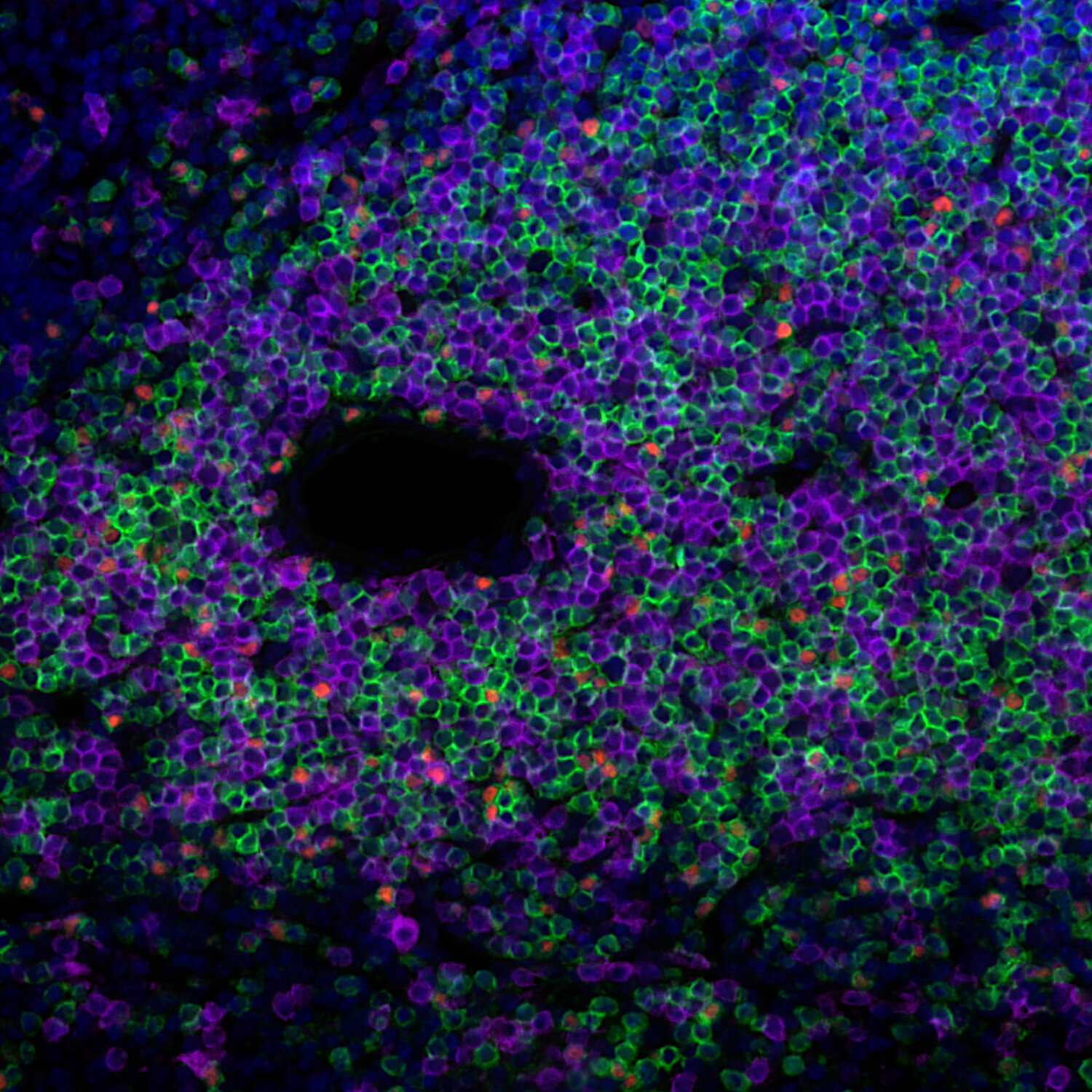 帯付き　Phi Phosphorescence CD Synaptic Systems - FoxP3